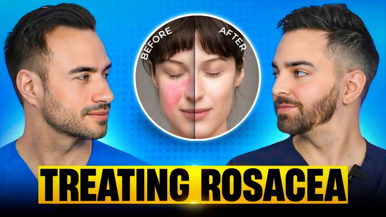 Treat Rosacea Like A Dermatologist