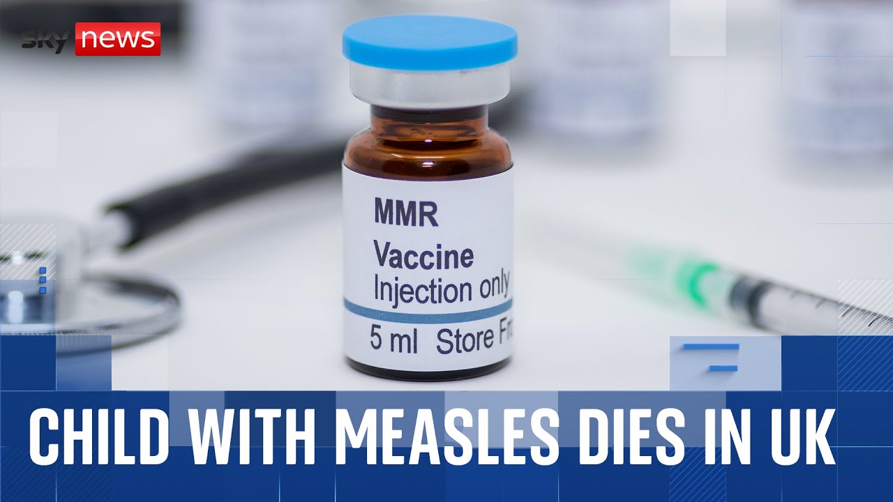 A child with measles has died at a Liverpool hospital