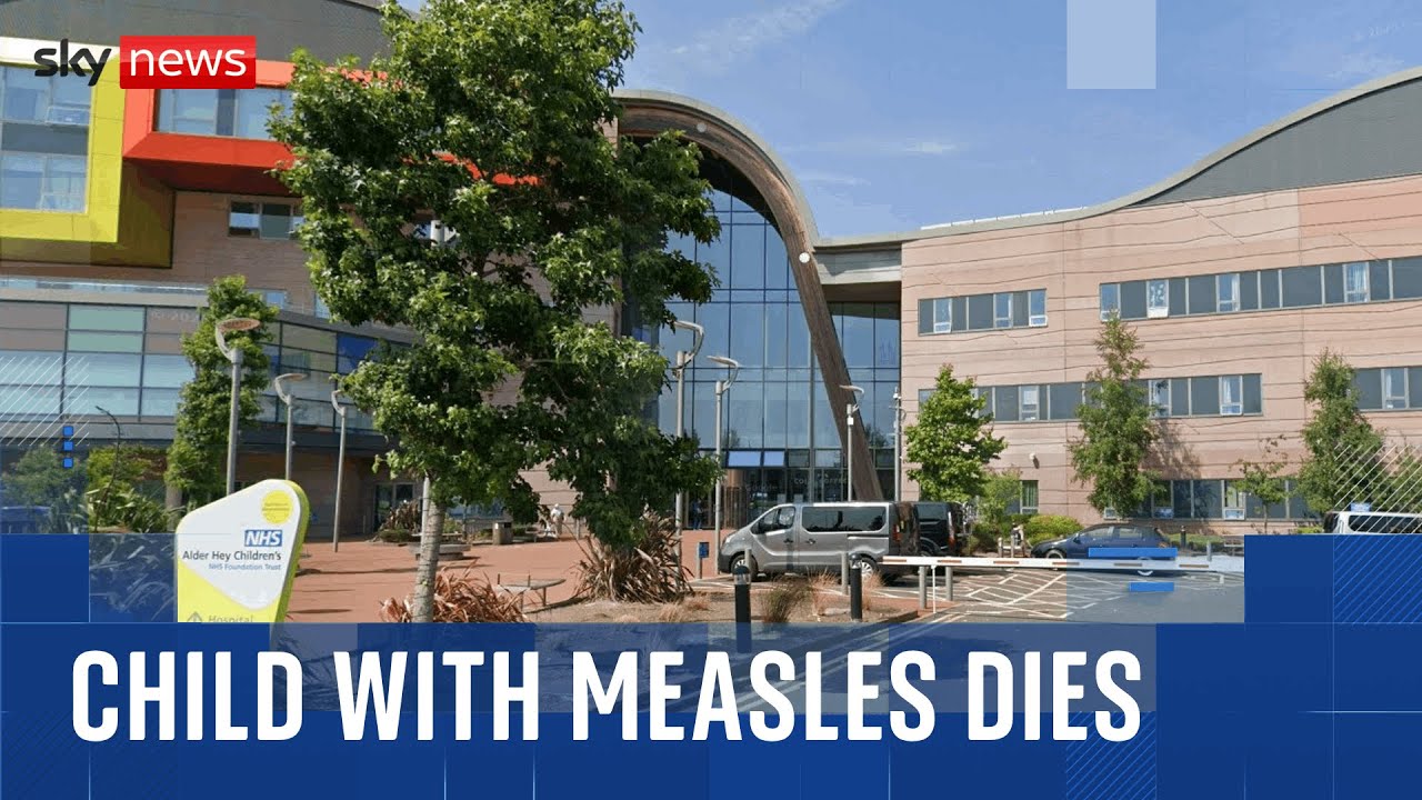 Child dies as measles cases surge at Liverpool hospital
