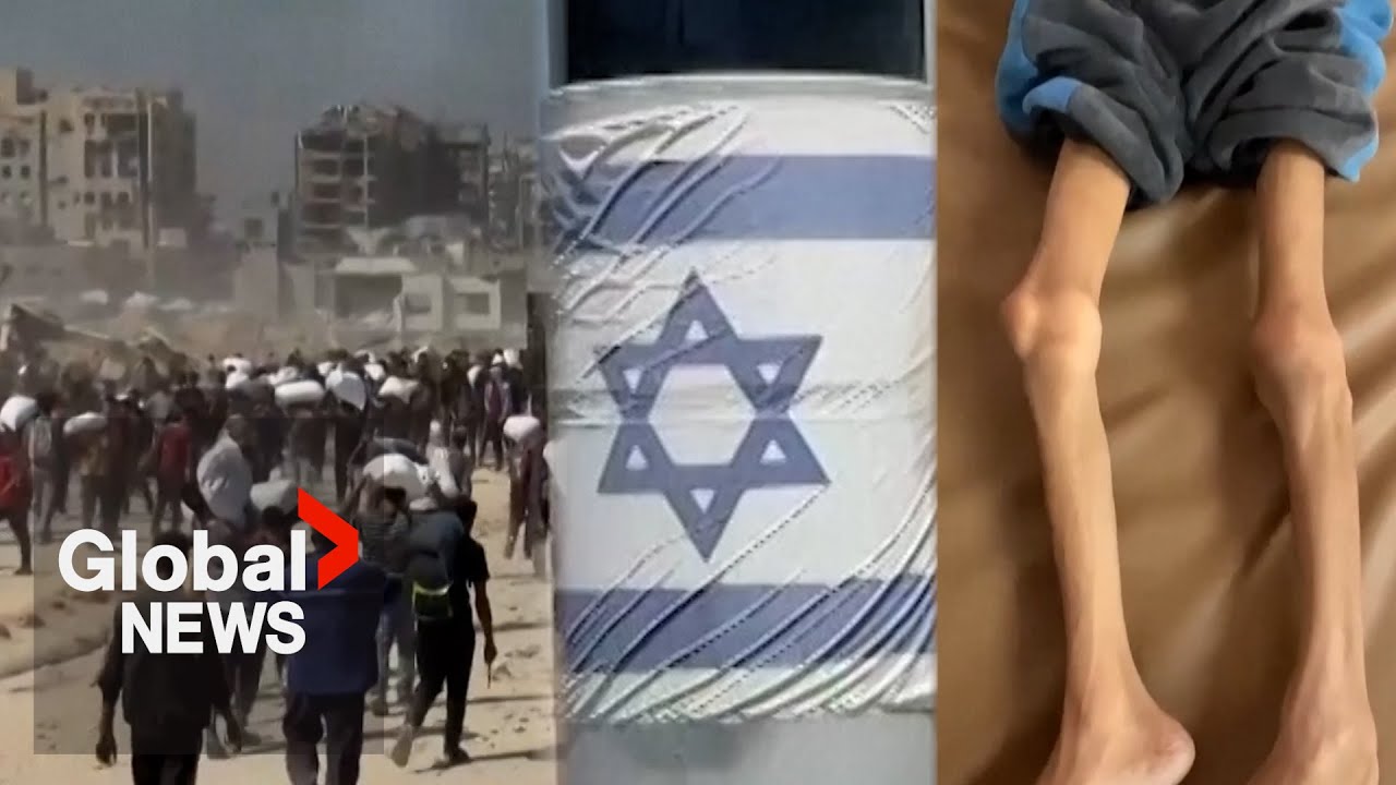 Children in Gaza unable to digest food after starvation, even as Israel allows aid, expert says
