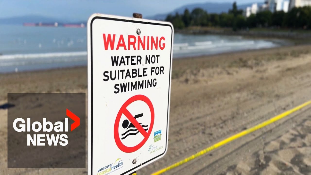 E. coli surge shuts down record number of Vancouver beaches for swimming