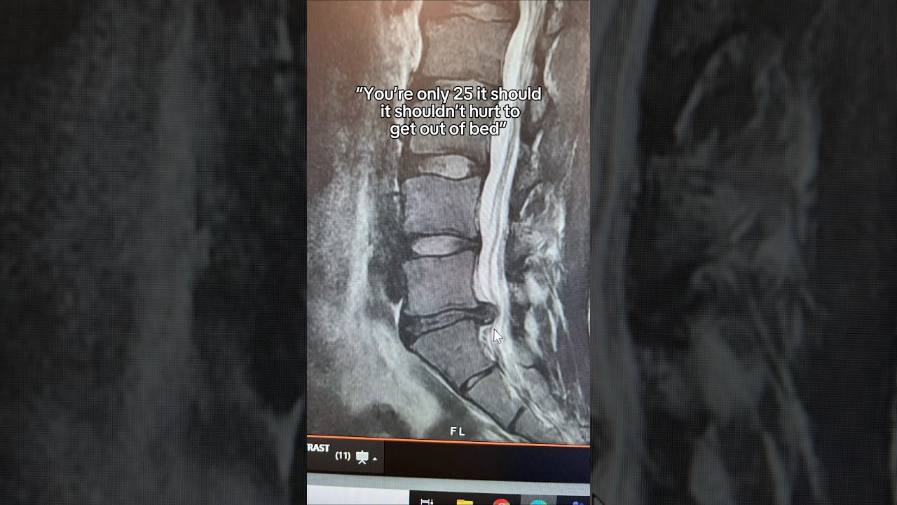 Hope this explains it 😅 #olympics #gymnastics #gymnast #olympic #sports #sport #fails #fail #injury