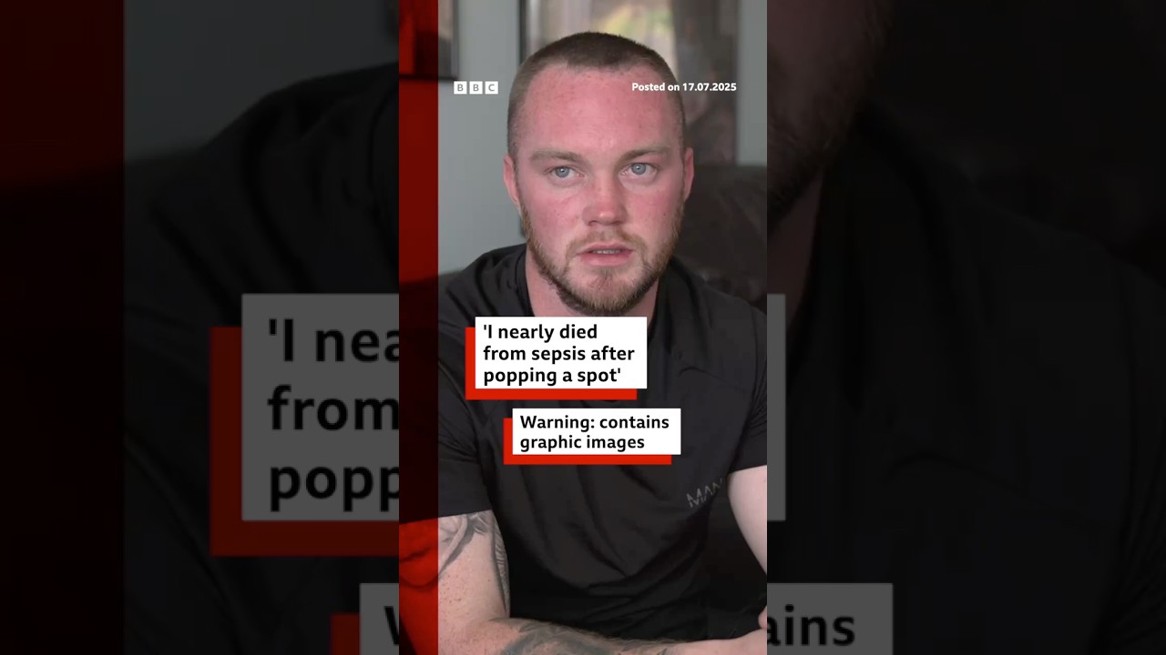 Popping a pimple led to a man getting sepsis. #BBCNews