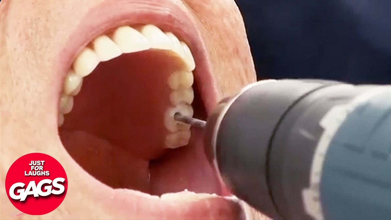 Why I Hate Dentists 🦷  | Just For Laughs Gags