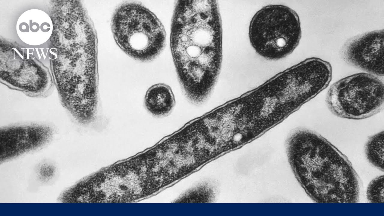 2 dead and 58 sick from growing Legionnaires’ disease cluster in New York City