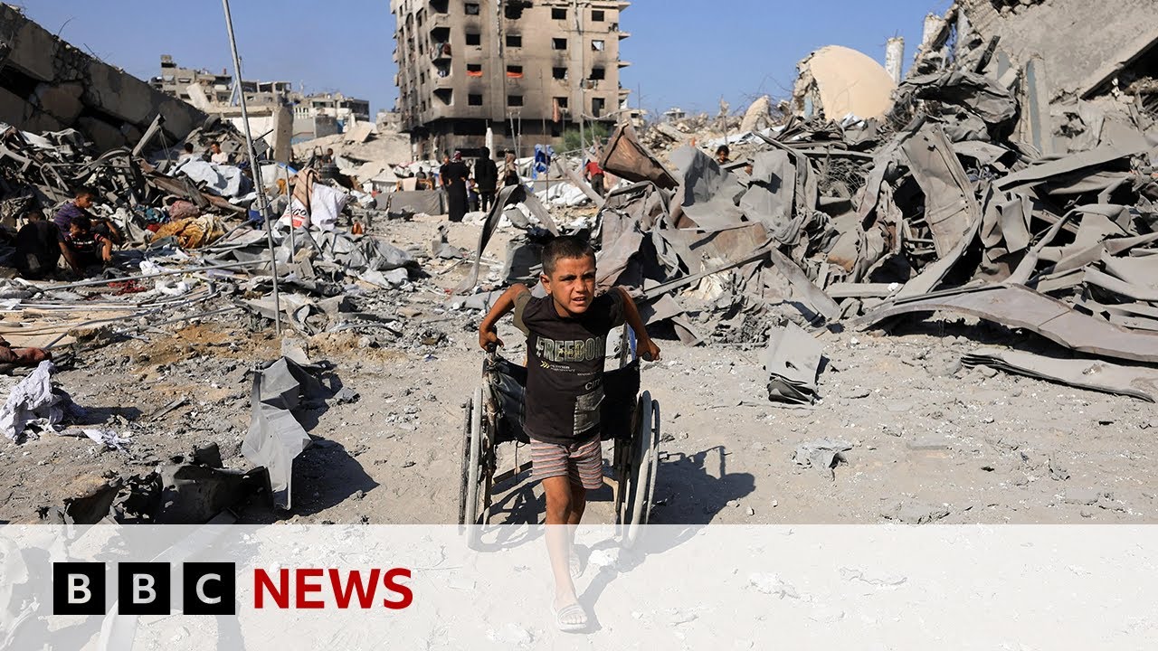 Children in Gaza ‘like zombies’ because of severe malnutrition, US doctor says | BBC News