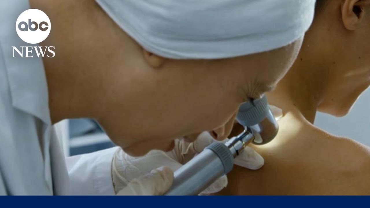 How to protect against melanoma