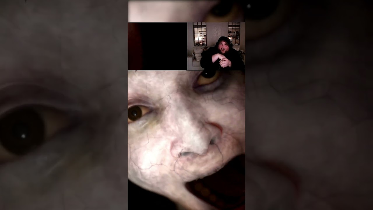 I May Never Recover From This Game