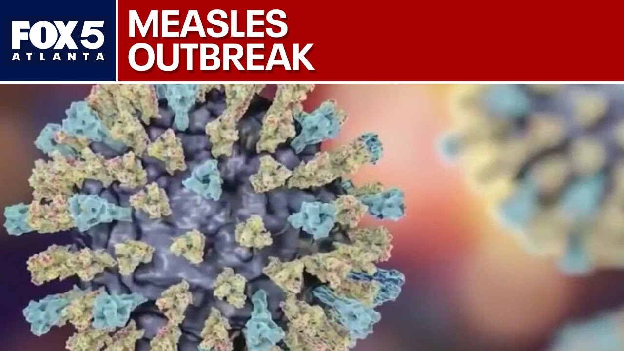 Measles cases on the rise in US | FOX 5 Nes