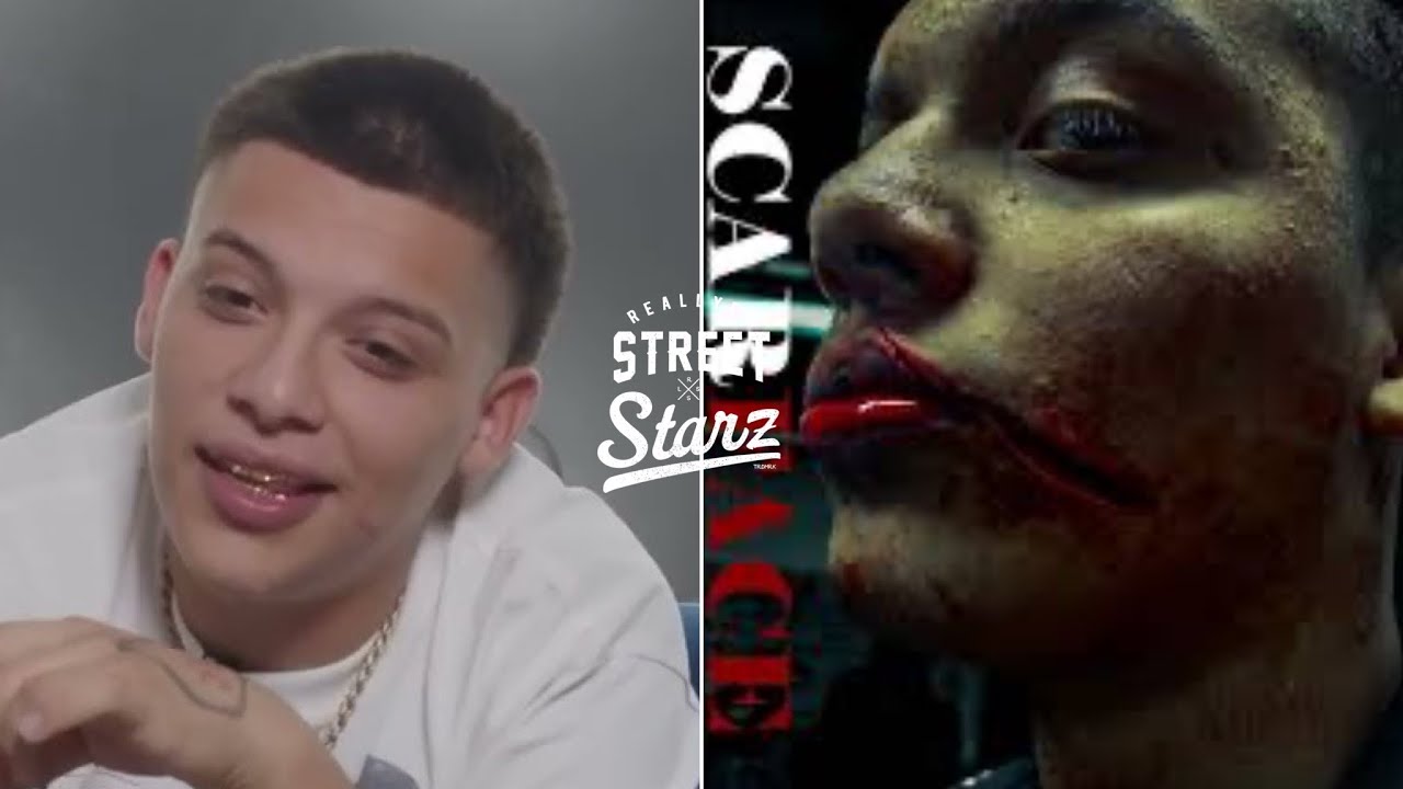 OC Chris explain why he got ST4BBED in the face by a WOMAN, the SCAR it left & what he LEARNED