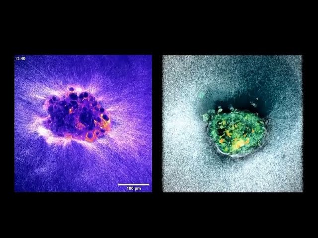 Spanish doctors created an artificial womb to solve a major cause of miscarriage