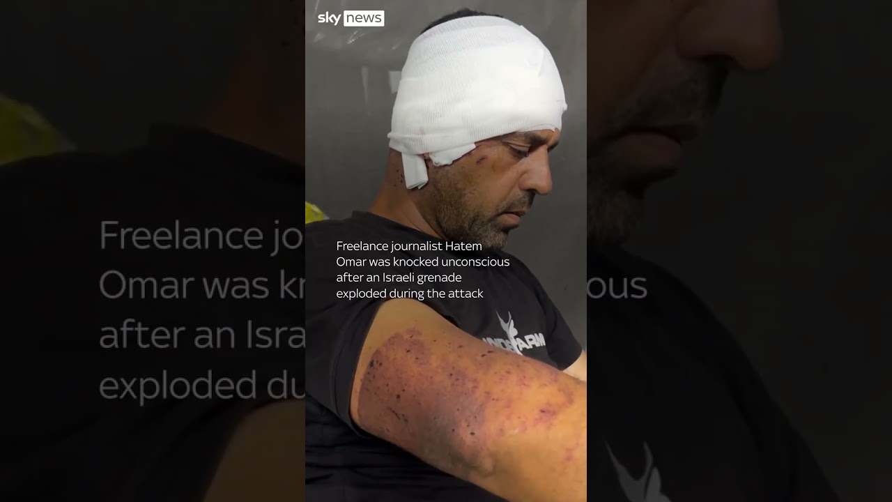 ‘When I woke up, everyone was dead except me’: Gazan journalist recalls strike on Nasser Hospital