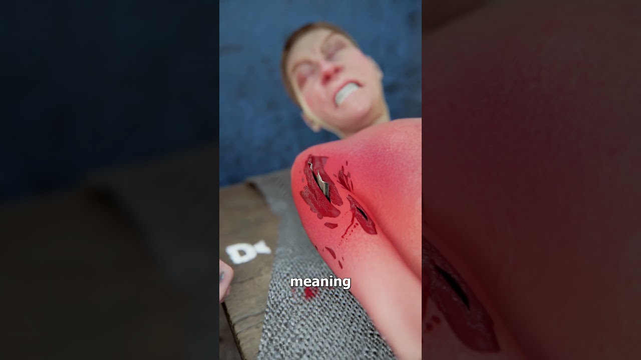 Why Soldiers Bit Bullets During Surgery 😨
