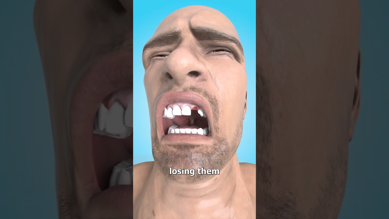 Why You Dream About Losing Teeth 🤔