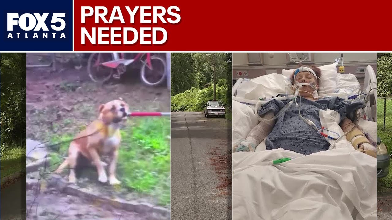 Woman critically injured in vicious dog attack | FOX 5 News