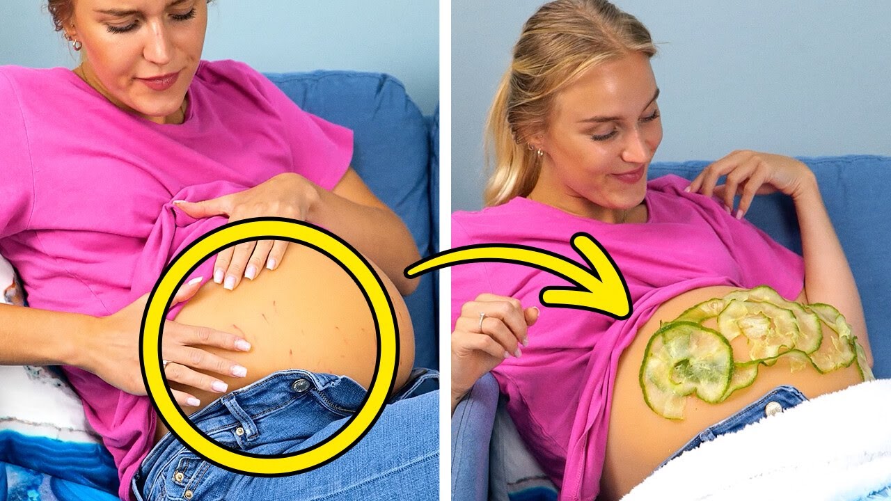 How to Get Rid of Stretch Marks? +Other Hacks Every Mom-to-Be Will Love 🤰💡