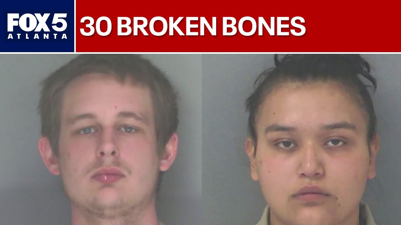 Infant found with 30 fractures, parents arrested | FOX 5 News