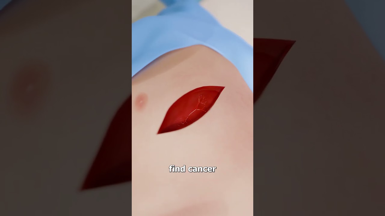 Seed Sprouts Inside A Man’s Lung 😱