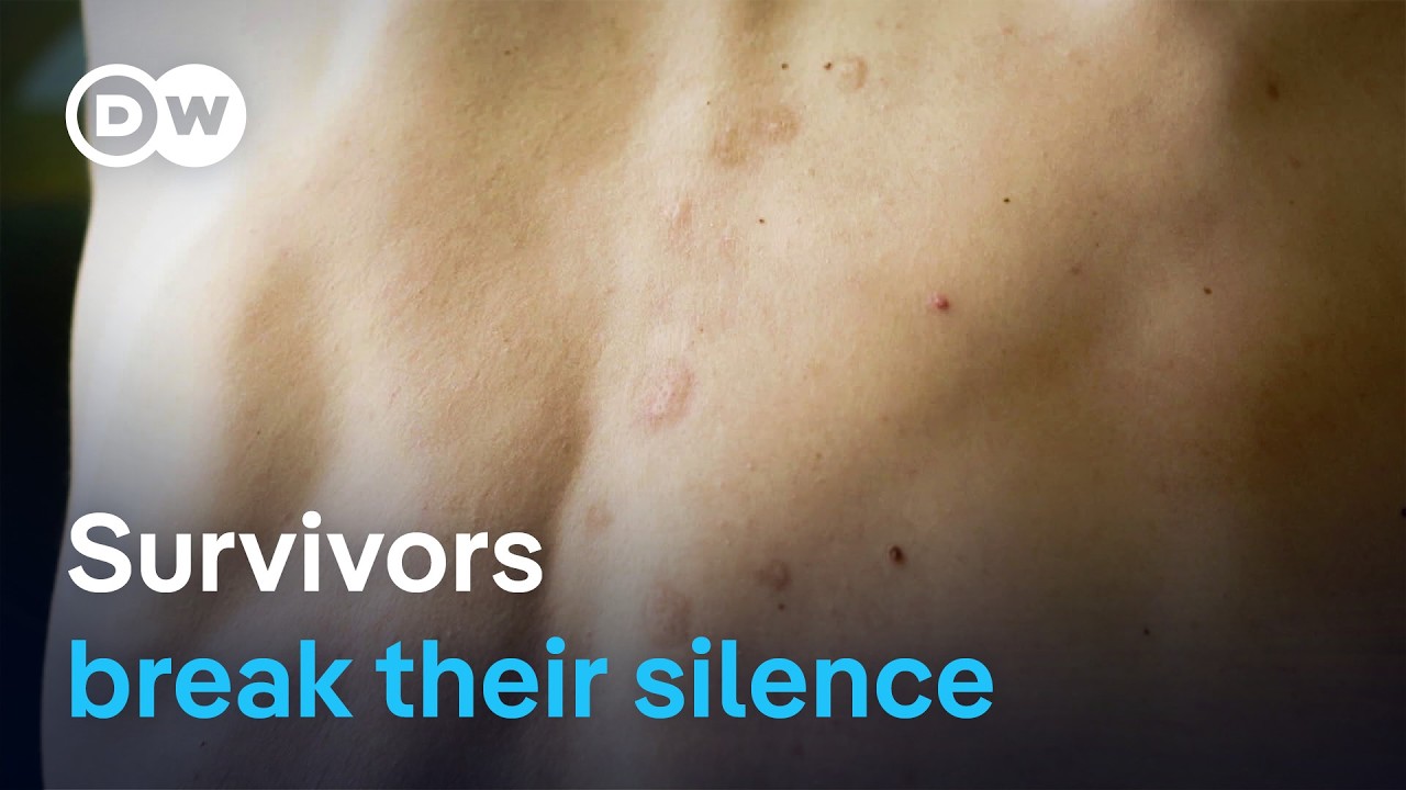 Weapon of war: Sexual violence against men | DW Documentary