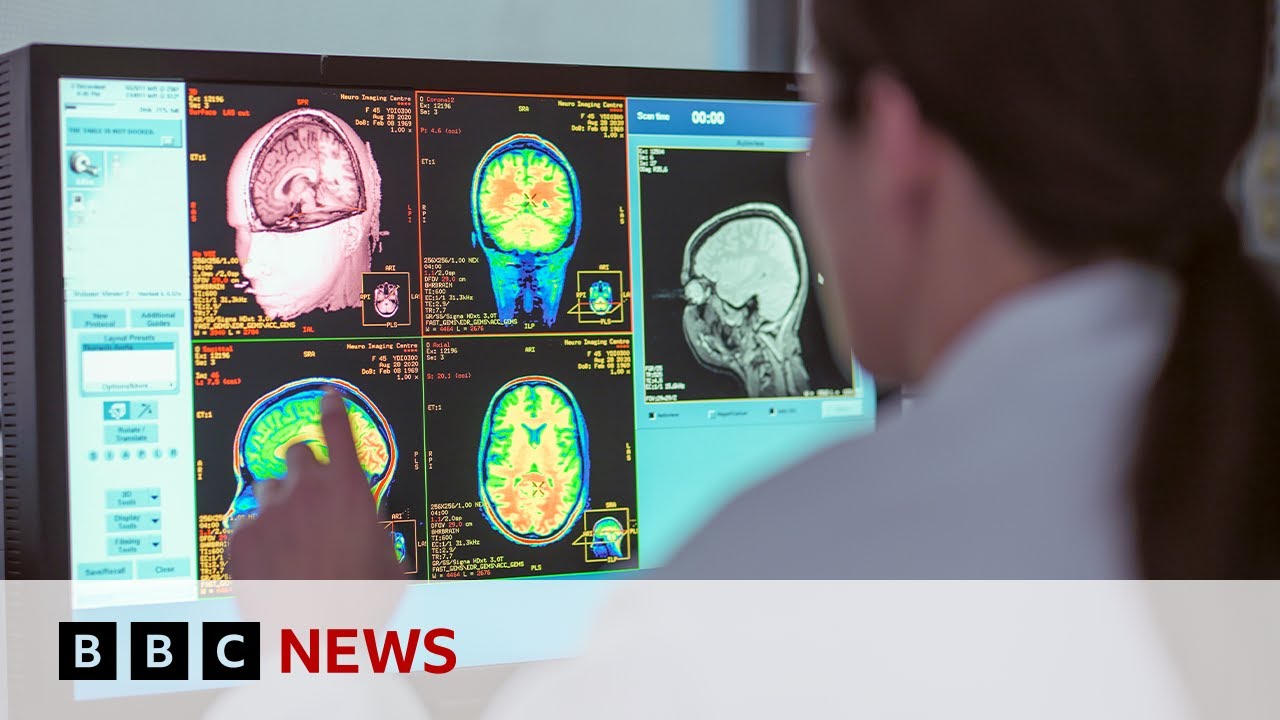 Adolescence lasts into 30s, new study shows | BBC News