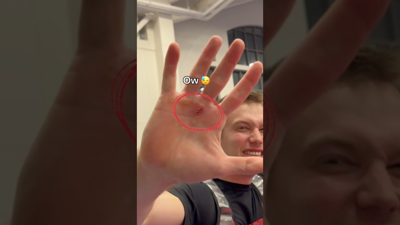 My hand ripped from all the weight 😭 #gymnastics #gymnast #olympics #sports #weight #strength #d1