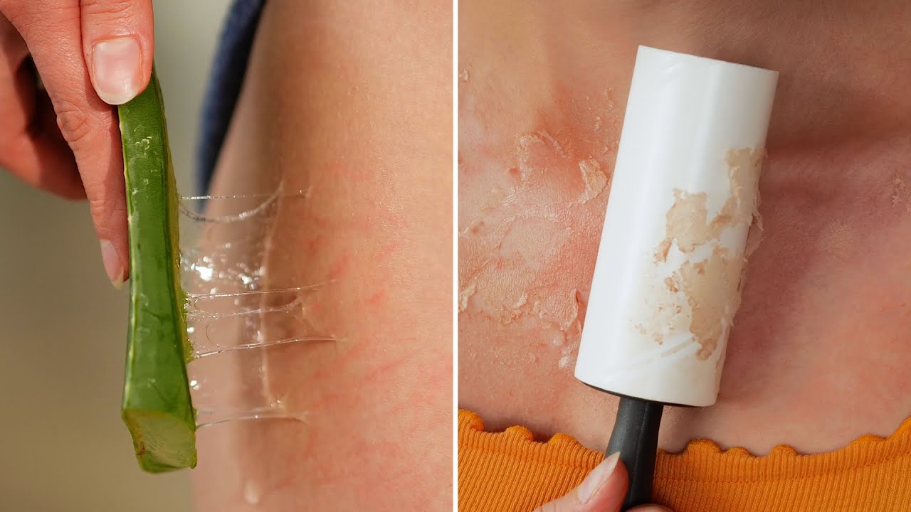 Smart Natural DIY Skincare Tricks to Keep Your Skin in Perfect Condition 🌿✨