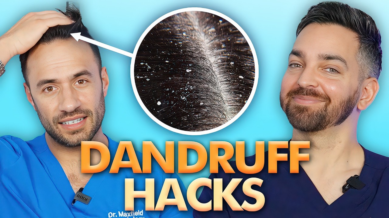 8 Dandruff Hacks that Will Change Your Life | Doctorly’s Guide