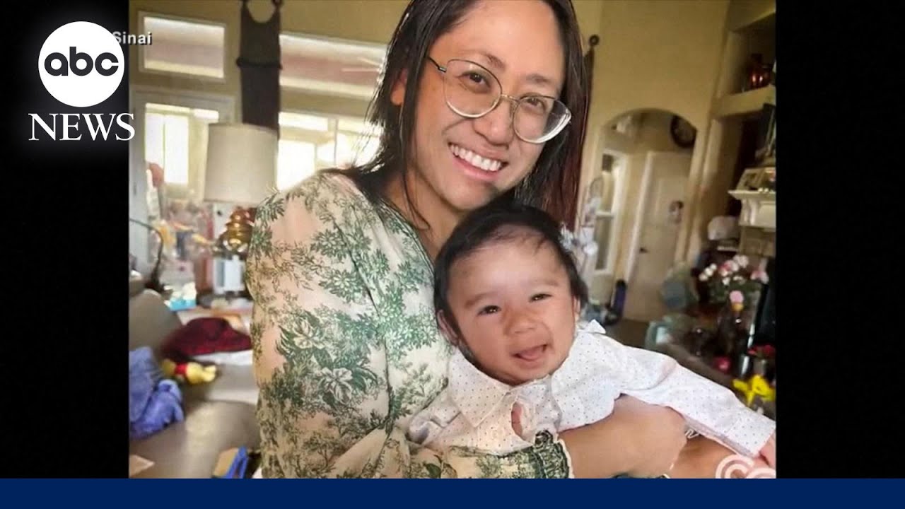 Doctors deliver baby while removing 22-pound tumor from mother