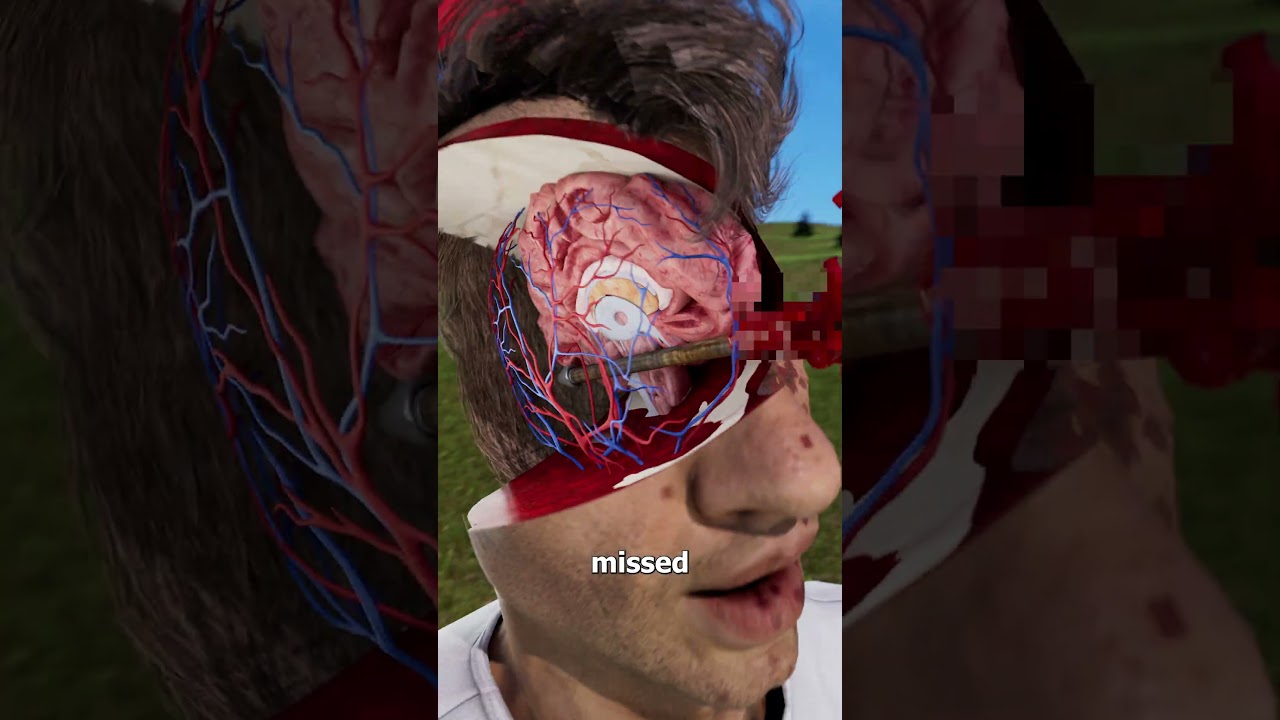 He Survived An Arrow Through His Skull 😵