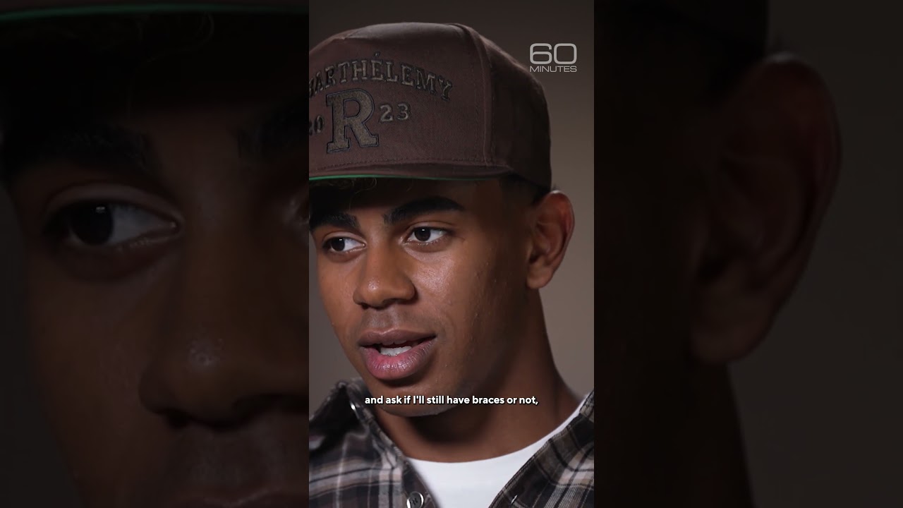 Lamine Yamal’s signature look: braces #shorts