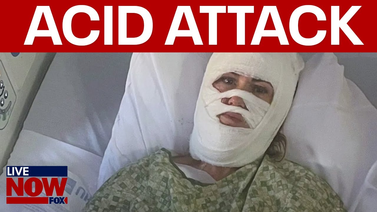 Savannah acid attack: Woman severely burned in “unprovoked attack”
