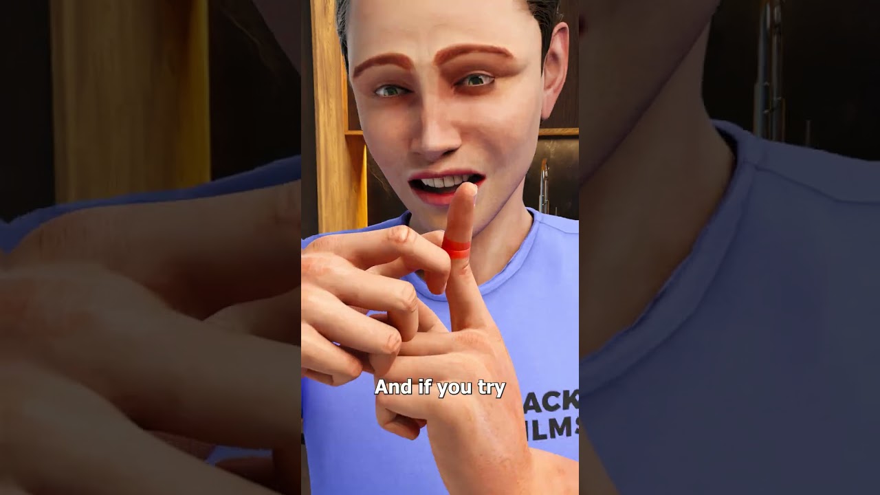 What Not To Do If You Cut Off Your Finger 😨