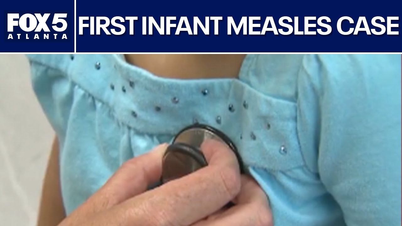 Georgia reports first 2026 measles case in infant | FOX 5 News