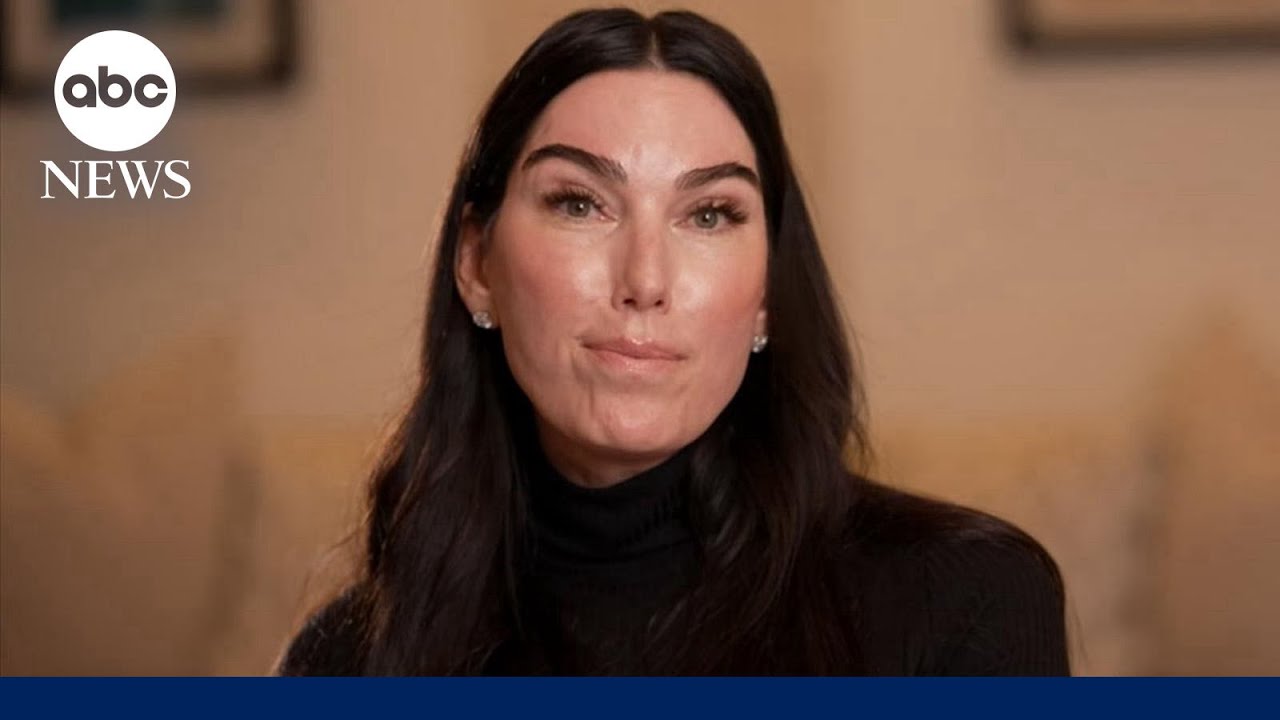 How eyebrow transplants can help people with sparse brows