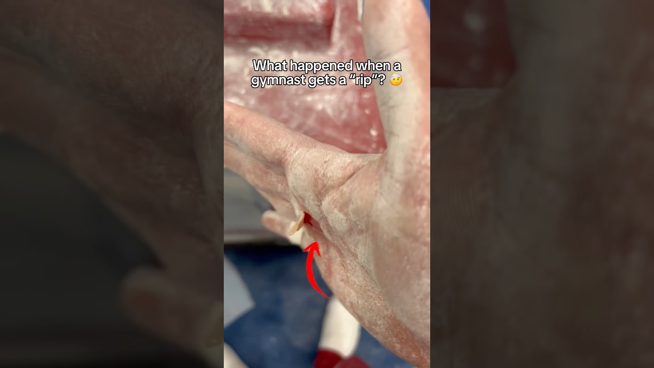 The skin at the end 🤢 #gymnastics #gymnast #olympics #olympic #sports #sport #calisthenics