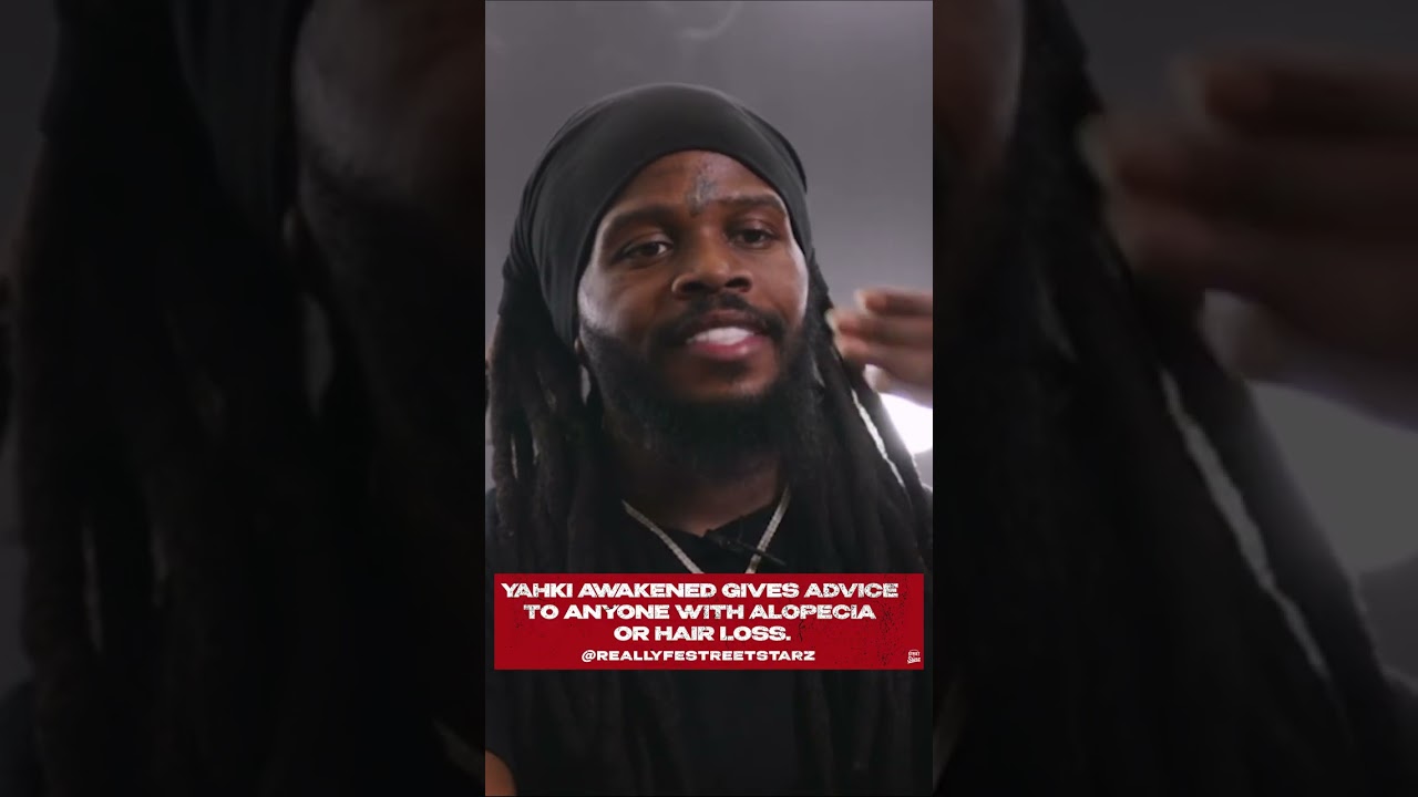 Yahki Awakened gives advice to anyone with ALOPECIA OR HAIR LOSS.