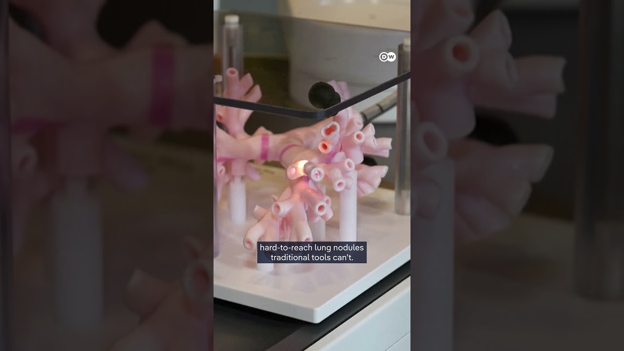 How robots will change healthcare | DW News