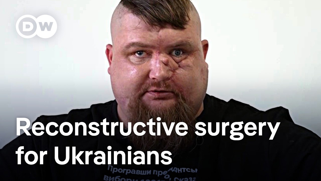 Reconstructing the faces of battered and bombed Ukrainian soldiers | DW News