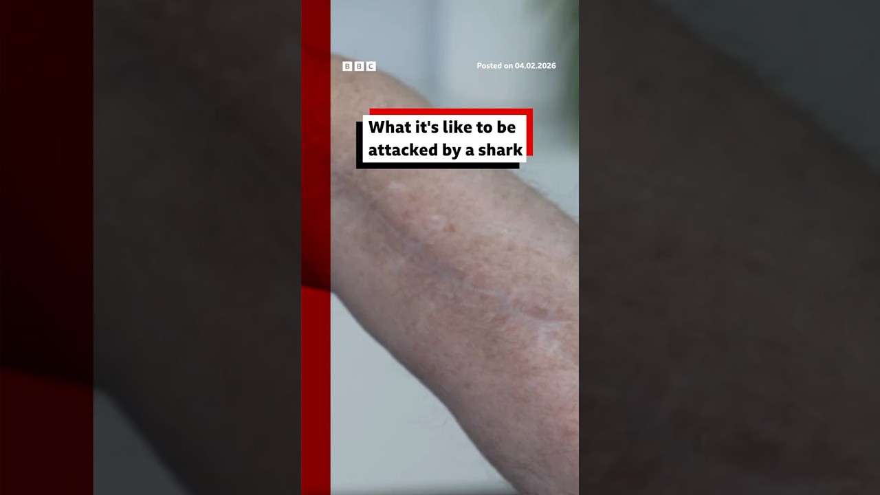 What it’s like to be attacked by a shark. #Sharks #SharkAttack #BBCNews