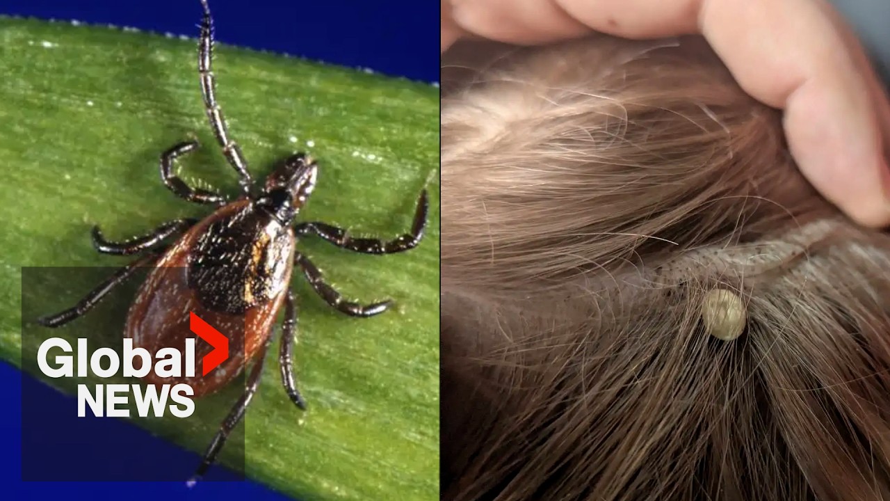 BC father speaks out after 6-year-old son suffers paralysis from tick bite