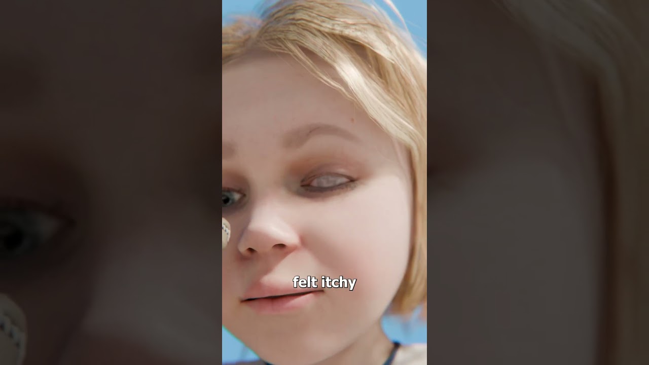 How A Simple Kiss Nearly Destroyed His Eye 😢