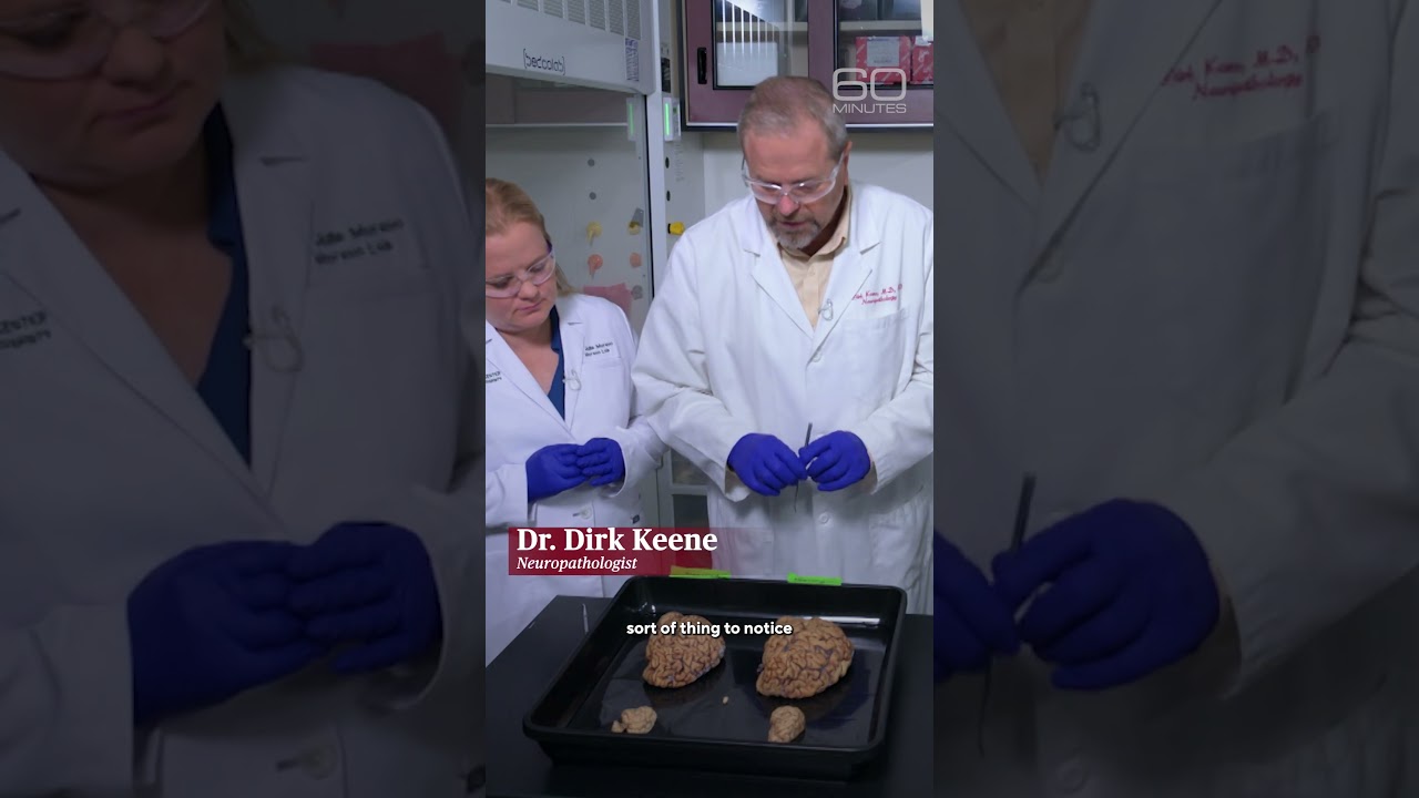 How dementia changes the brain #shorts