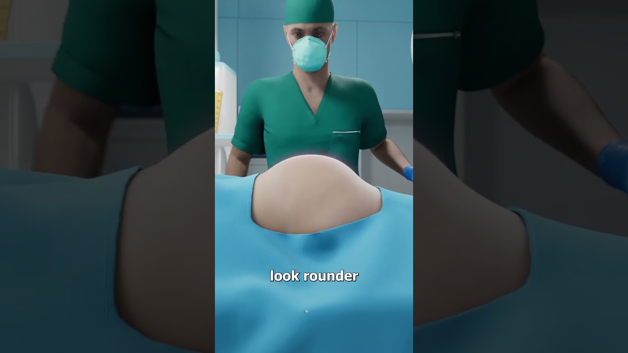 Why Rich People Inject Dead People’s Fat 😬