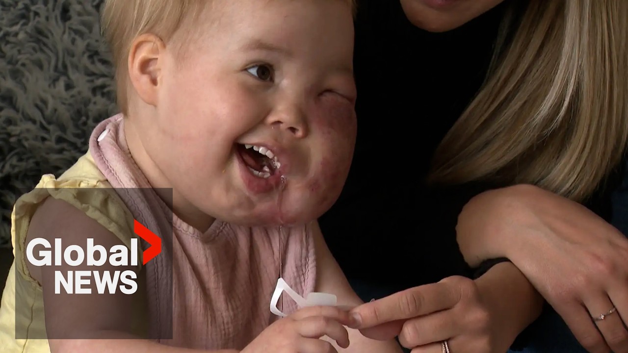 Alberta family faces “uncertain future” after funding refused for medical care