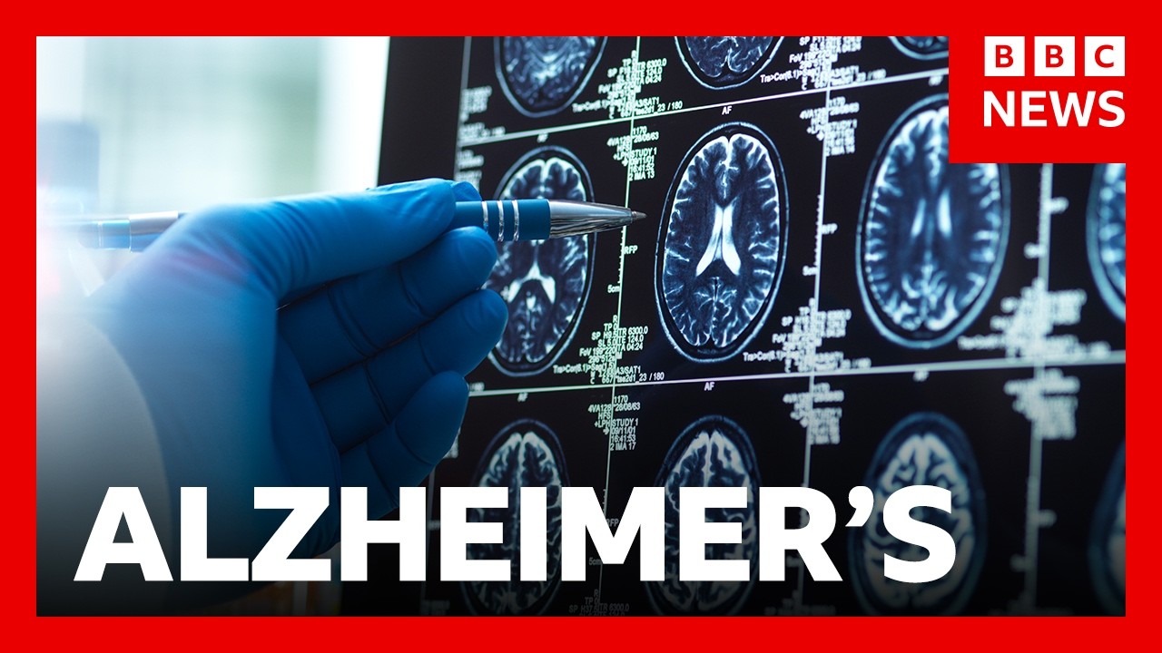 ‘Breakthrough’ Alzheimer’s drugs unlikely to benefit patients, report suggests | BBC News