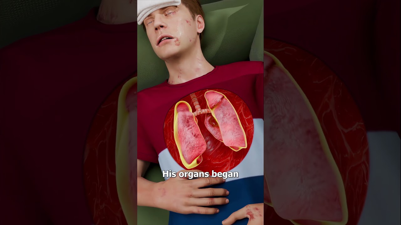 How An Ingrown Hair Put Him In A Coma 😨