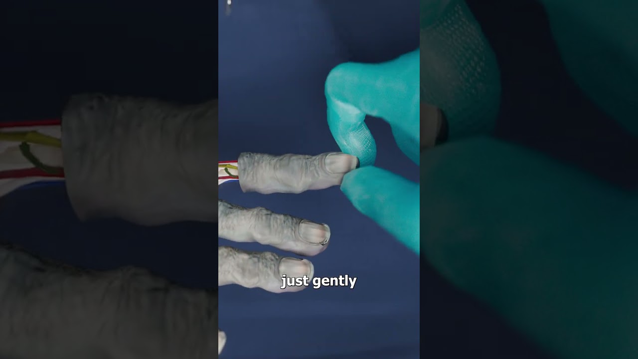 How Are Fingerprints Recovered From A Corpse 😮