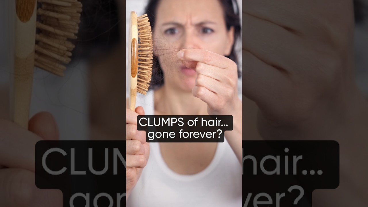 How I Treated my Thinning Hair #shorts