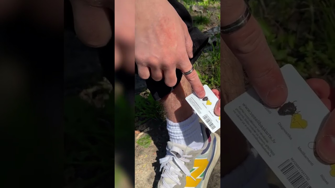 How to Remove a Tick Quickly