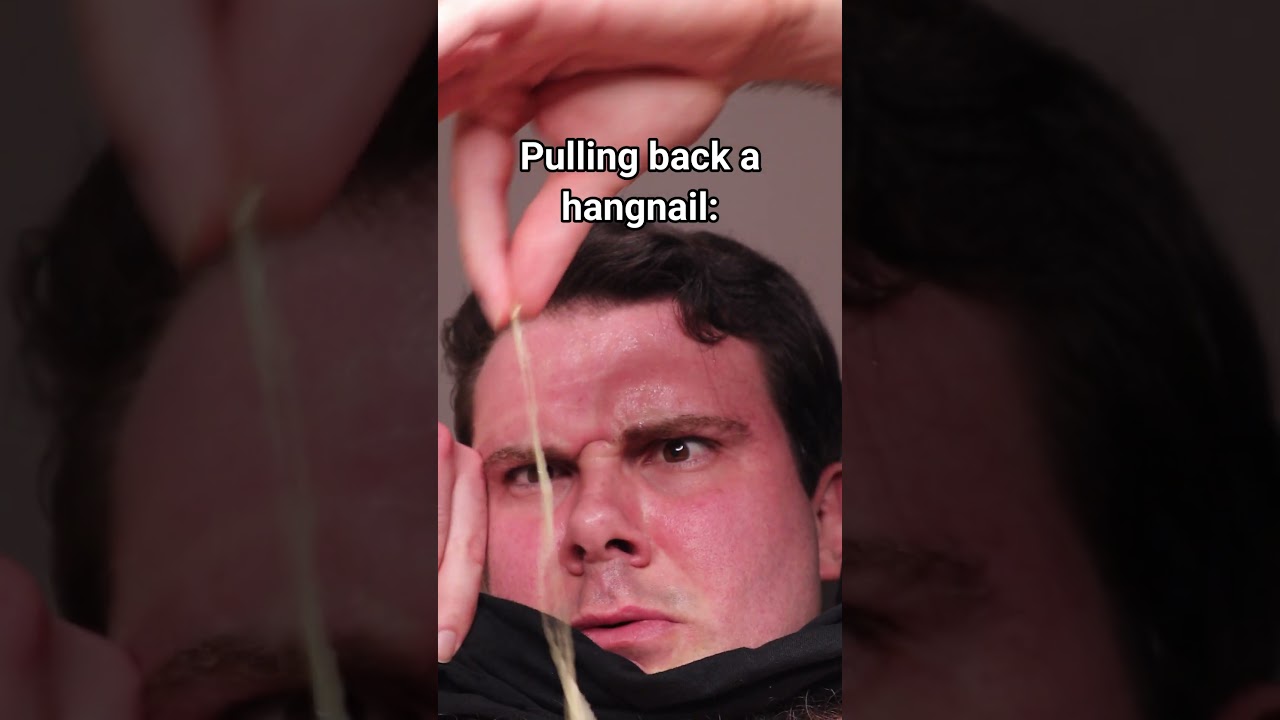 Pulling Back A Hangnail.